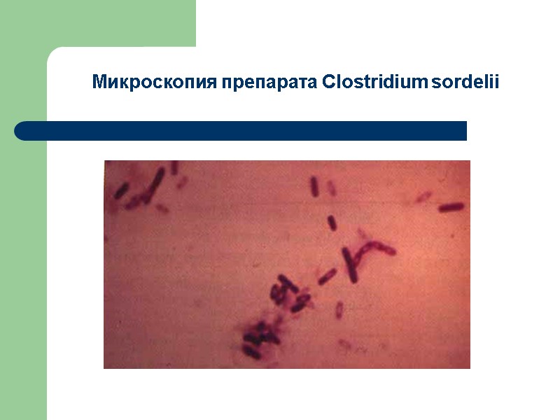 Микроскопия препарата Сlostridium sоrdelii